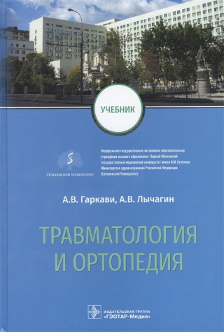 Гаркави